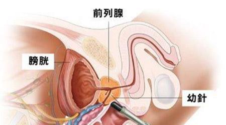 宜春哪个医院治膀胱炎