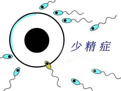 宜春少精症患者平时要注意哪些