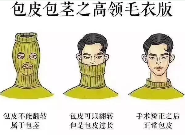 真人自述丨割包皮的真实流程!快进来看看吧!-预约手术