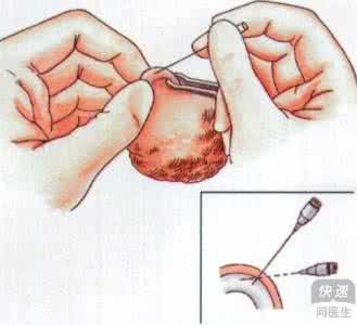 “小蝌蚪受刑记”宜春精囊炎治疗要多少钱