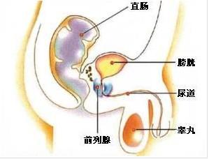 清除前列腺内病菌的“工程”如何实施
