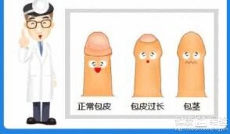 宜春包皮每个男宝宝不可忽视